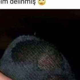 ignecimcan