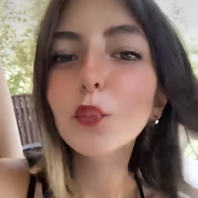 kawasakiss