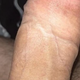 erkan474