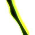 Gazay