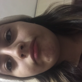 Nurmiyo