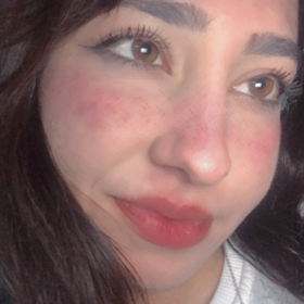 aleeeyiste1